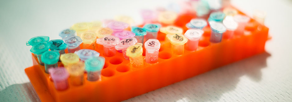 Tray of lab specimens in vials