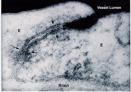 An electron micrograph shows tight passages between the endothelial cells that make up the blood-brain barrier