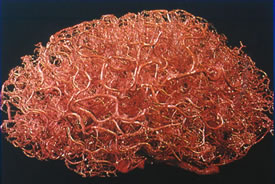 A 3D brain-shaped sculpture shows the intricate blood vessel structure of the human brain