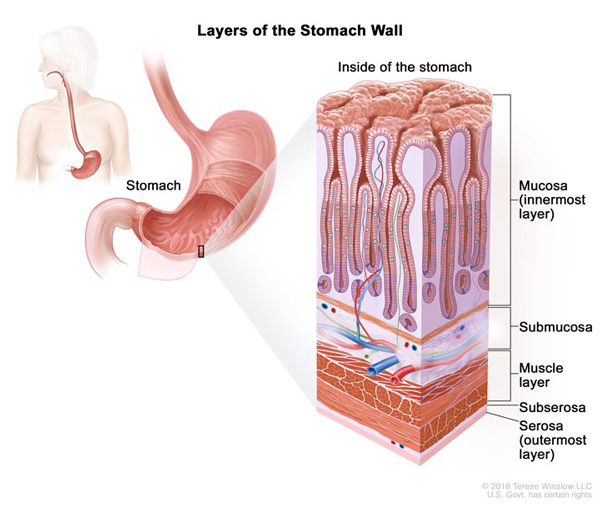 Medical illustration of the layers of the stomach wall, with inset showing detail including (from innermost to outermost layer) the mucosa, submucosa, muscle layer, subserosa, and serosa.