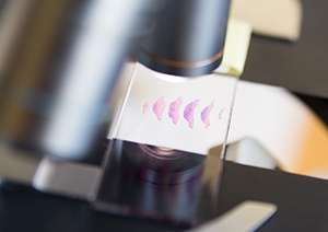 A microscope looking at a skin tissue slide.