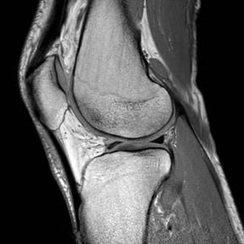MSK Knee Image for radiology