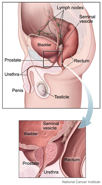 Medical illustration of the prostate and nearby organs, by Alan Hoofring