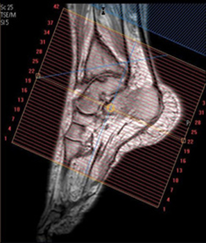 MR Ankle WO Radiology Protocol image 2