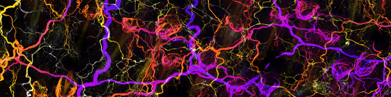 Innervation of the skin by somatosensory neuron axons (image courtesy Matt Pomaville)