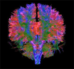 White matter tracts from 3T in vivo human diffusion imaging, found in a MRI scan of the brain