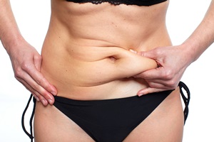 Photo of a woman pinching a roll of tummy fat between her fingers