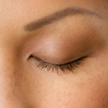 Blepharoplasty, eyelift surgery or ptosis surgery can dramatically improve the look of the upper eyelid.