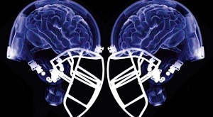 Transparent football helmets showing the human brain to highlight sports concussions. 