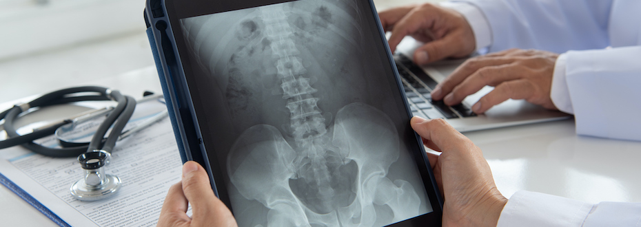 Hands holding a tablet that is displaying a spine X-ray image.