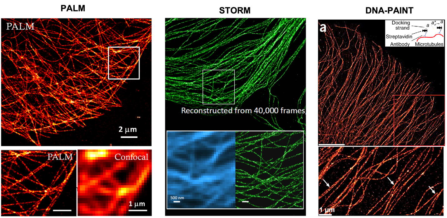 Figure 2. Superresolution imaging of microtubules in cultured cells with PALM (left), STORM (middle), and DNA-PAINT (right). The STORM image is taken from ref [13], and the DNA-PAINT image from ref [8].