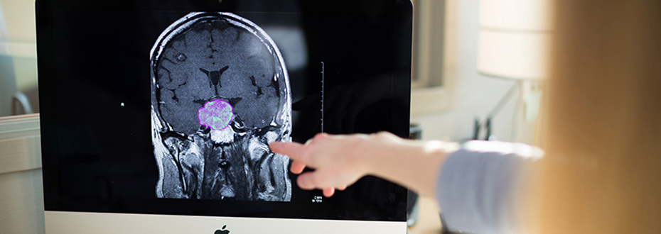 Pituitary Center Craniopharyngioma page banner image - provider pointing at an imaging scan on a monitor