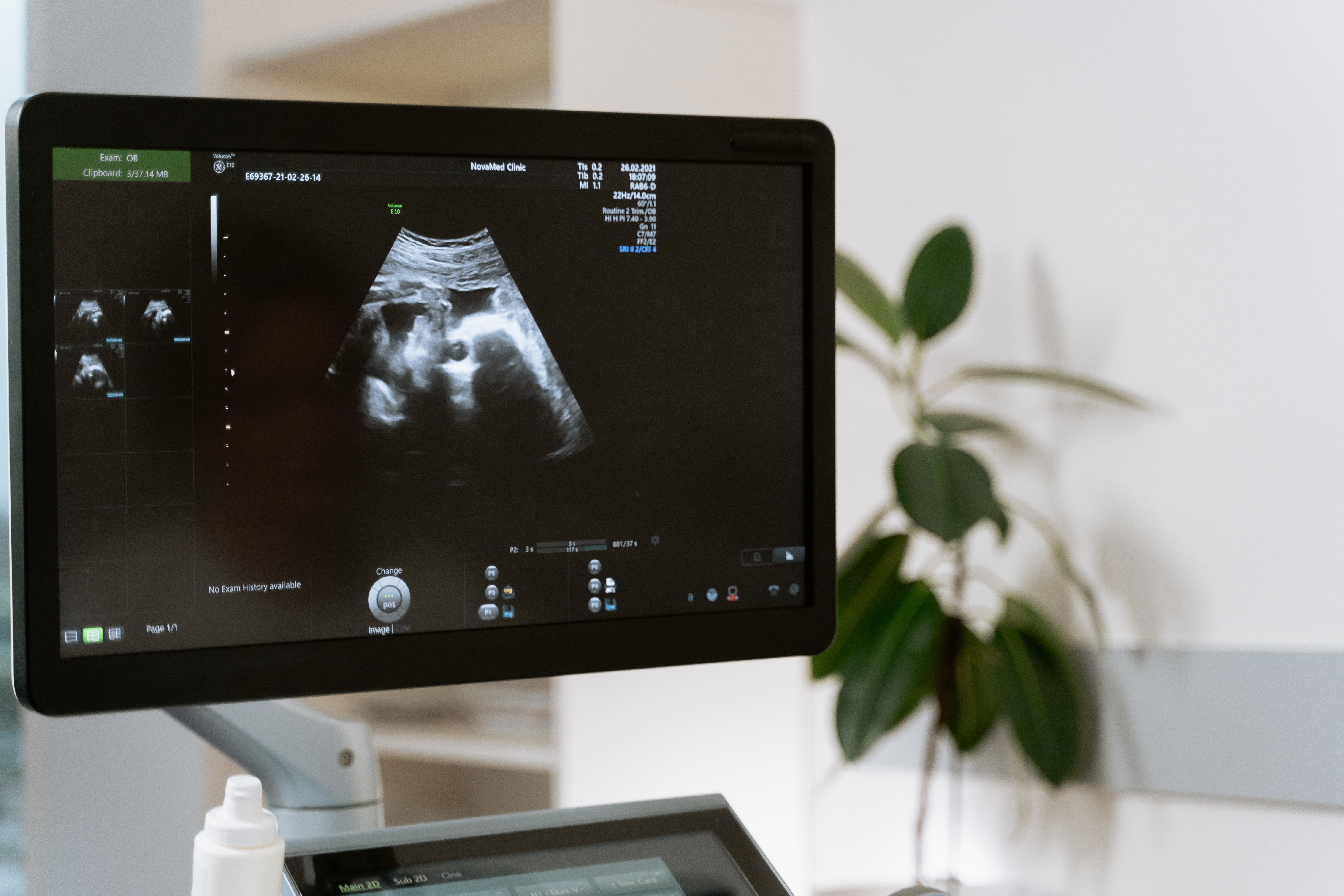 An ultrasound machine showing a black and white projection of an unborn baby.