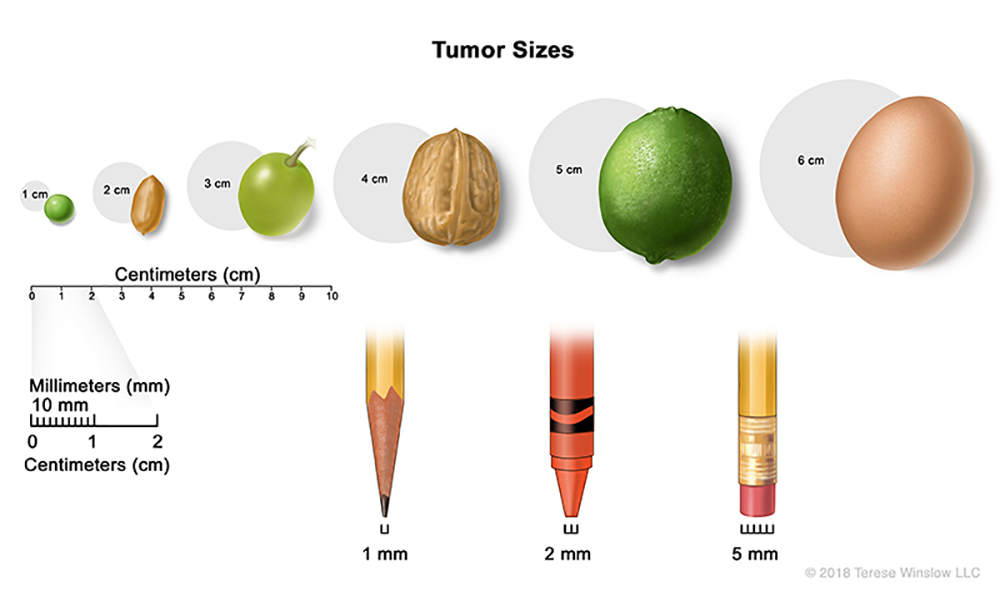 Tumor sizes