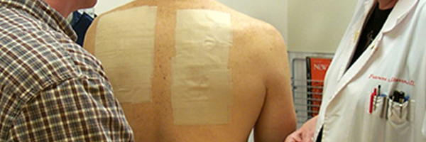 A patient undergoing patch testing.