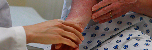 A patient with psoriasis is seen by a doctor.