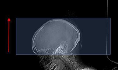 CT Head with contrast positioning image for scanning protocol