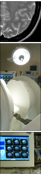 Images from and of IntraOperative MRI