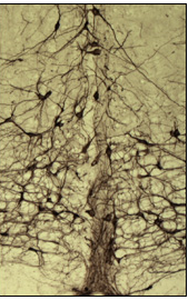 Rostral Ventral Medulla Neurons