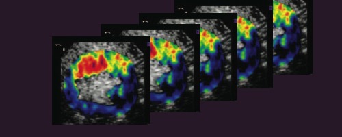 Contrast enhanced ultrasound targeted imaging developed and refined by OHSU scientists provides a potent research method for the study of physiology.