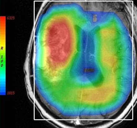 MRI Spectroscopy image for Radiology