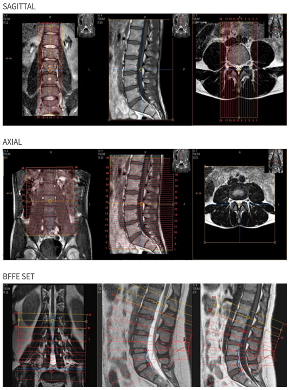 MR Spine Protocol Positioning Images for radiology protocols