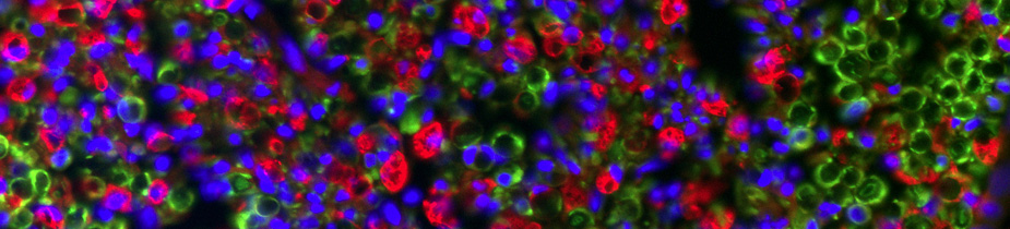 Regenerating mouse nerve shows glia and immune-cells. (Image courtesy Amit Mogha)