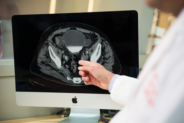 Dr. Jeremy Cetnar reviews a patient scan. He is a medical oncologist who focuses on urologic and lung cancers.