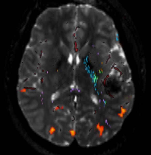 Diagnostic Radiology fMRI Brain