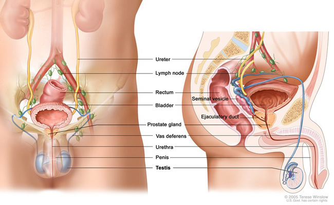 Medical illustration of male urogenital anatomy. Cancer in a testicle, or testis, affects a gland that makes and stores sperm. The two testicles also make testosterone.