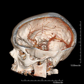 Diagnostic Radiology skull reconstruction