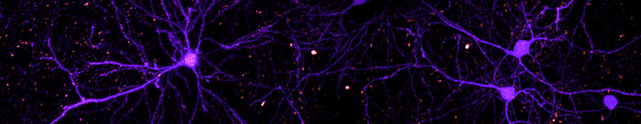 Pseudo-colored image of neurons