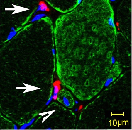 BM-MNCs Implanted in Muscle Tissue