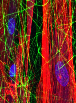Tropoelastin fibers (green) with smooth muscle cells
