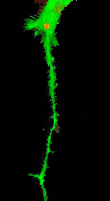 Flourescent Nerve Cell