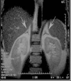 MR Adrenal Mass WWO BODY Protocol image