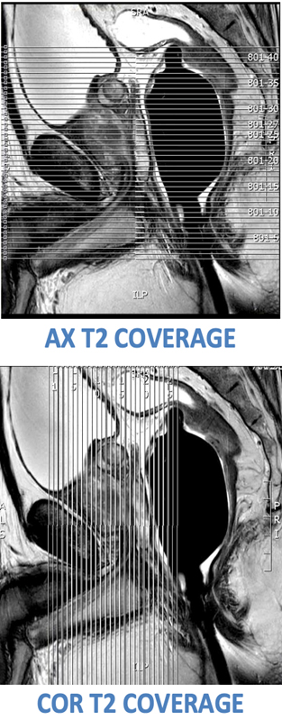 MR Adult Prostate WWO Protocol image 1