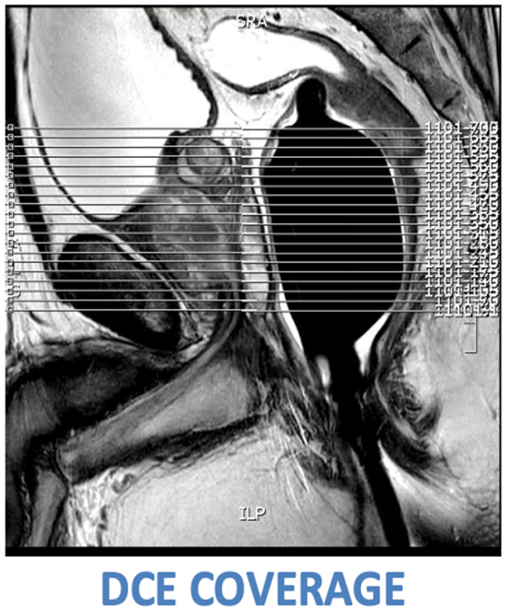 MR Adult Prostate WWO Protocol image 2