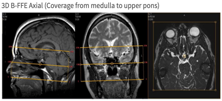 MR Brain WWO Neuro Protocol Axial Image
