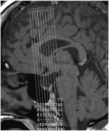 MR Dynamic Pituitary WWO Neuro Protocol image