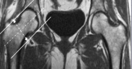 MR Hip Ortho Detail MSK Protocol image 1