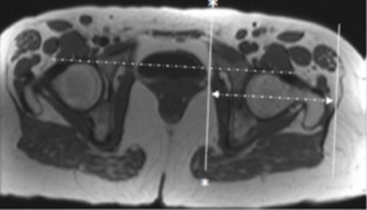 MR Hip Ortho Detail MSK Protocol image 3