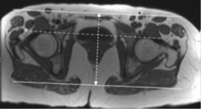 MR Hip Ortho Detail MSK Protocol image 4