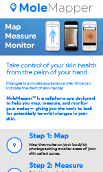 MoleMapper™ iPhone application