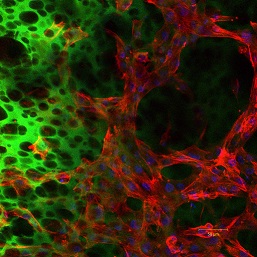Stem Cells Growing on Biomaterial Matrix
