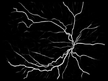 Black and white image of blood vessels in the eye taken with technology developed at Casey