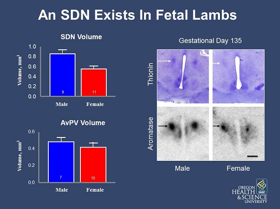 An SDN exists in fetal lambs