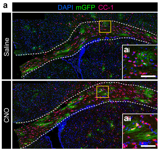 Genetic fate mapping of adult generated oligodendrocytes (mGFP+) in the mouse brain during DREADD-induced neural activity. From Mitew et al. 2018 (graphic)