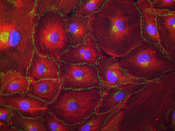 Image of endothelial outgrowth cells.