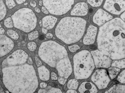 EM micrograph cross-section of a larval nerve with glial membranes (dark gray) surrounding axons